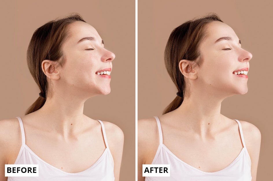 Perfect Skin Before and After